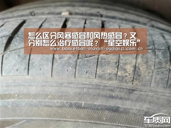 怎么区分风寒感冒和风热感冒?又分别怎么治疗感冒呢?“星空娱乐”(图3) 星空体育